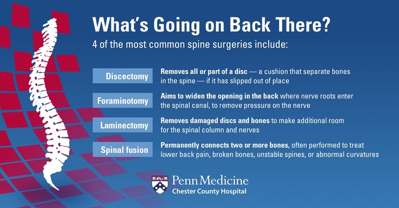 4 Common Spine Surgeries